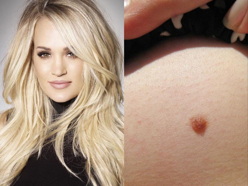 Carrie Underwood’s Third Nipple 19