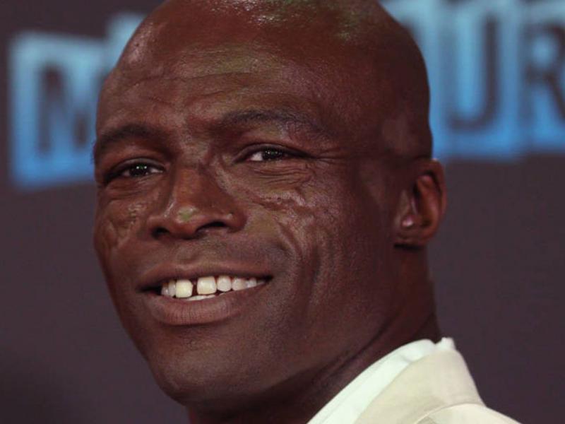 Seal’s Facial Scars 20