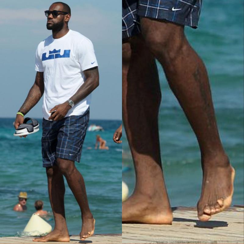 Lebron James’ Abnormal Toe 8